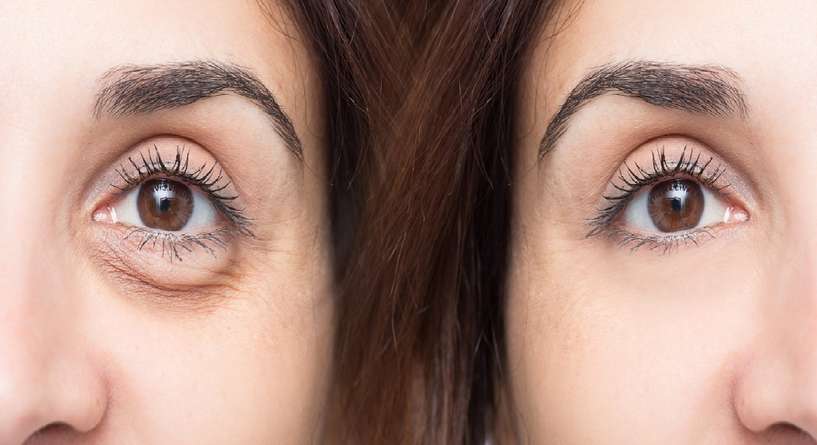 Contact Lens, Face, Person