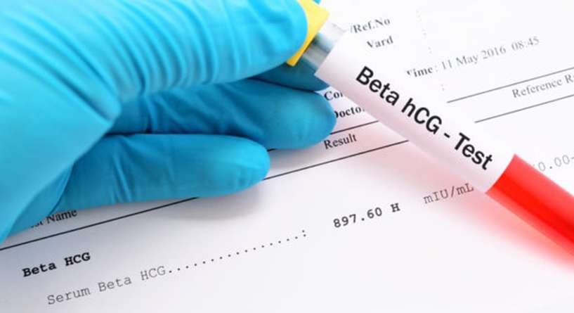 كيف اقرا نتيجة تحليل الدم للحمل وما مدى دقته؟