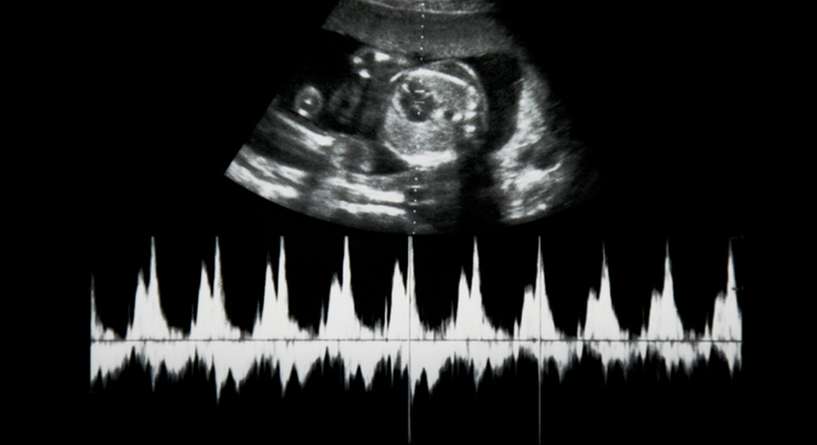 هل تخطيط قلب الجنين ضروري