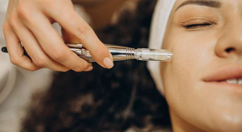 طريقة إستخدام ابرة الرؤوس السوداء