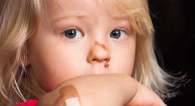 الاسعافات الاولية للاطفال