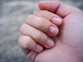 على ماذا تدل النقط البيضاء فى الاظافر