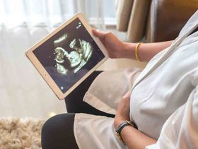 كيف يكون شكل الجنين في الشهر الثالث في بطن امه