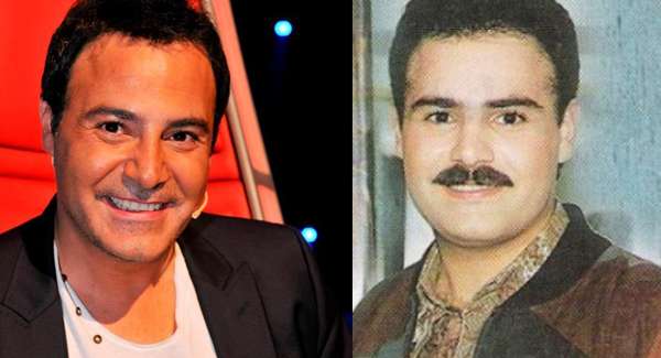 صور فنانون رجال قبل وبعد عمليات التجميل
