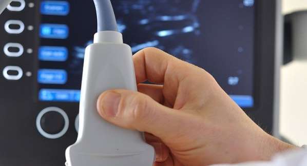 أهمية أشعة الصبغة في تشخيص العقم