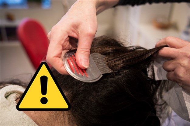 أم تشارك طريقة مذهلة لتفادي إنتشار القمل ما بين اطفالها