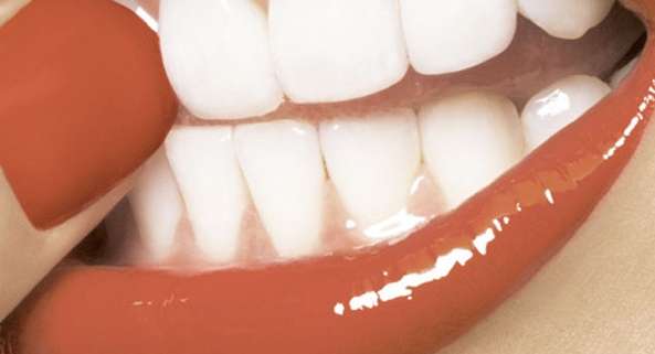 تمتعي بإبتسامة هوليوودية Hollywood Smile