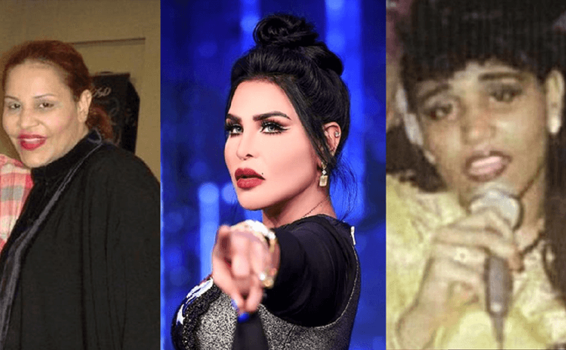 صور احلام قبل وبعد عمليات التجميل