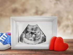 كيف اعرف اني حامل بولد من الشهر الرابع