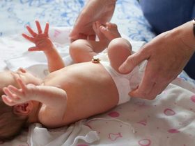 هل حزام فتق السرة للرضع آمن وكيف يمكن علاج هذه المشكلة؟