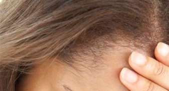 الإمعان في التفكير مرتبط بالإكتئاب وفقدان الذاكرة