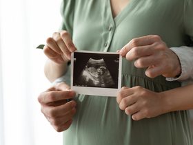 الفرق بين البنت والولد في السونار